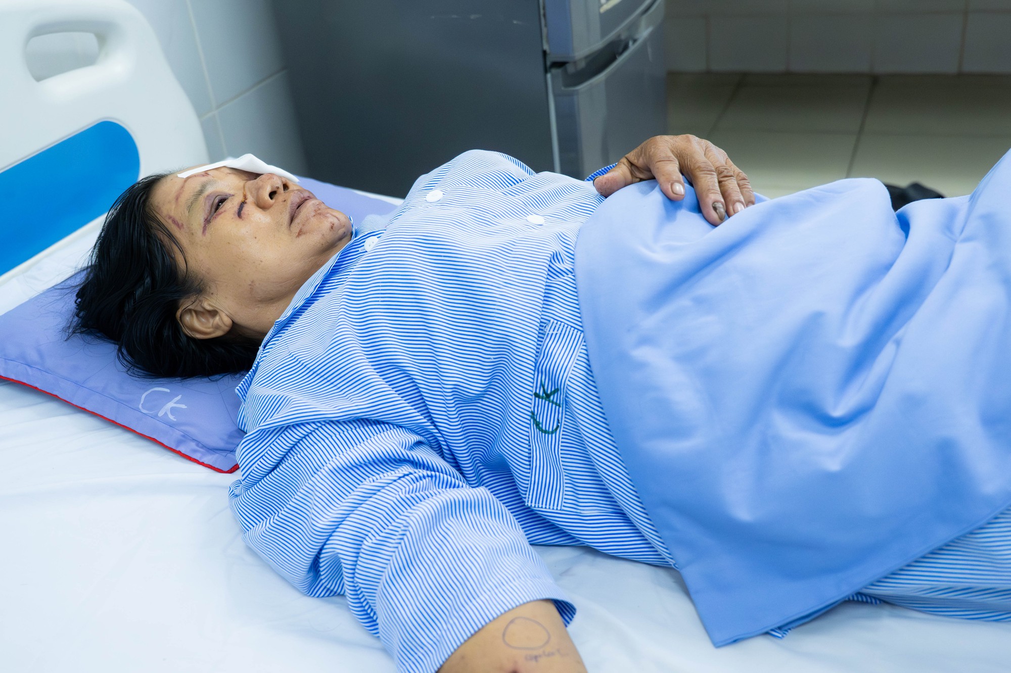 Gặp người phụ nữ b&aacute;n rau bị xịt nước chảy m&aacute;u mắt ở Ph&uacute; Thọ: "Nước xối v&agrave;o mạnh lắm, đau r&aacute;t, tối mắt tối mũi"- Ảnh 1.