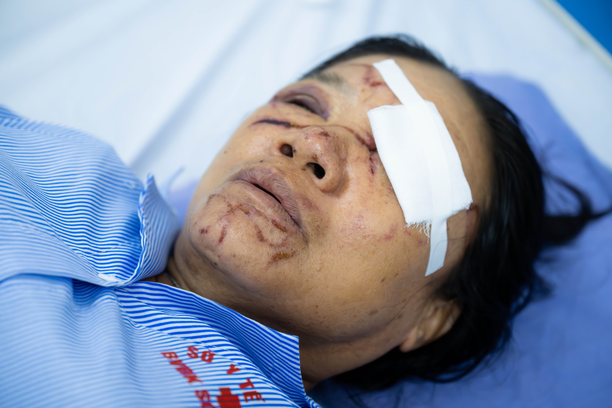 Gặp người phụ nữ b&aacute;n rau bị xịt nước chảy m&aacute;u mắt ở Ph&uacute; Thọ: "Nước xối v&agrave;o mạnh lắm, đau r&aacute;t, tối mắt tối mũi"- Ảnh 2.