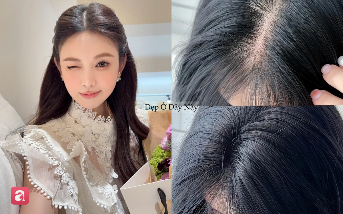 5 lọ dưỡng serum t&oacute;c "made in Vietnam" được nhiều chị em y&ecirc;u th&iacute;ch v&igrave; gi&uacute;p t&oacute;c mọc tua tủa, giảm rụng thấy r&otilde; - Ảnh 1.