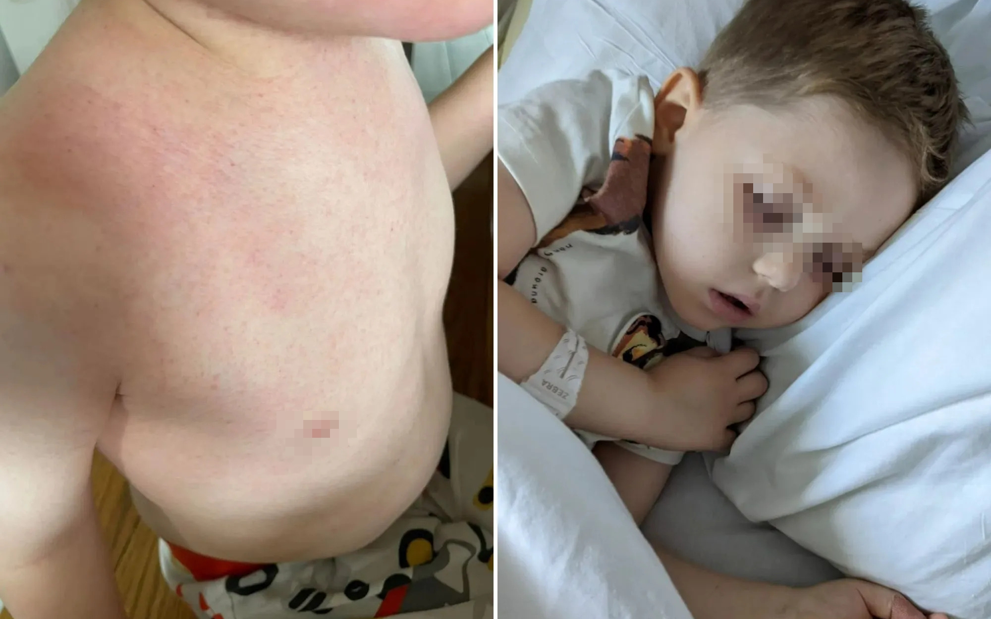 Tin mạng x&atilde; hội, bệnh nh&acirc;n ung thư suy kiệt sau 3 th&aacute;ng ăn ki&ecirc;ng - Ảnh 2.