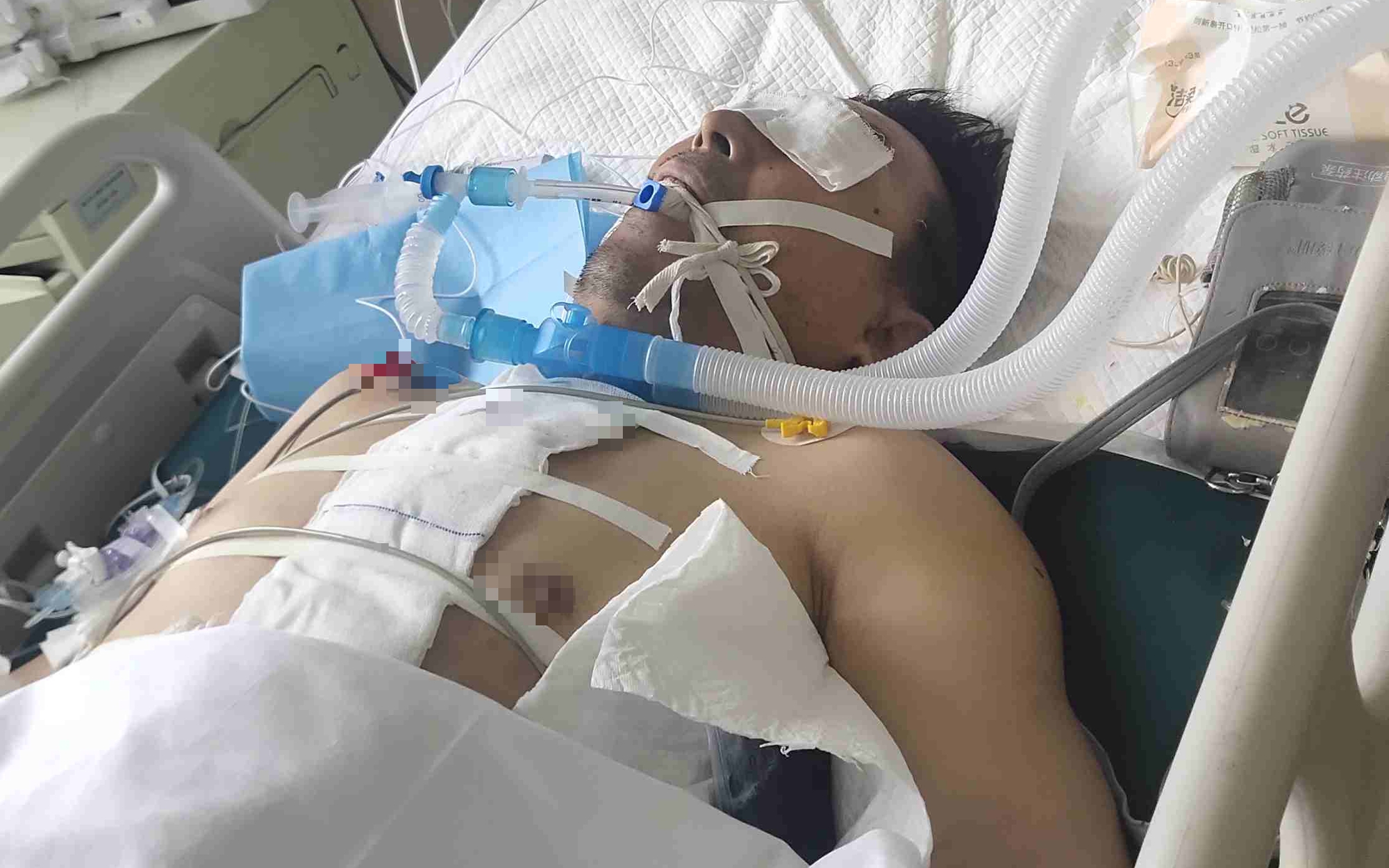 6 thực phẩm được chứng minh l&agrave; c&oacute; nguy cơ g&acirc;y ung thư, nhiều người Việt vẫn ti&ecirc;u thụ h&agrave;ng ng&agrave;y m&agrave; kh&ocirc;ng hề hay biết - Ảnh 3.