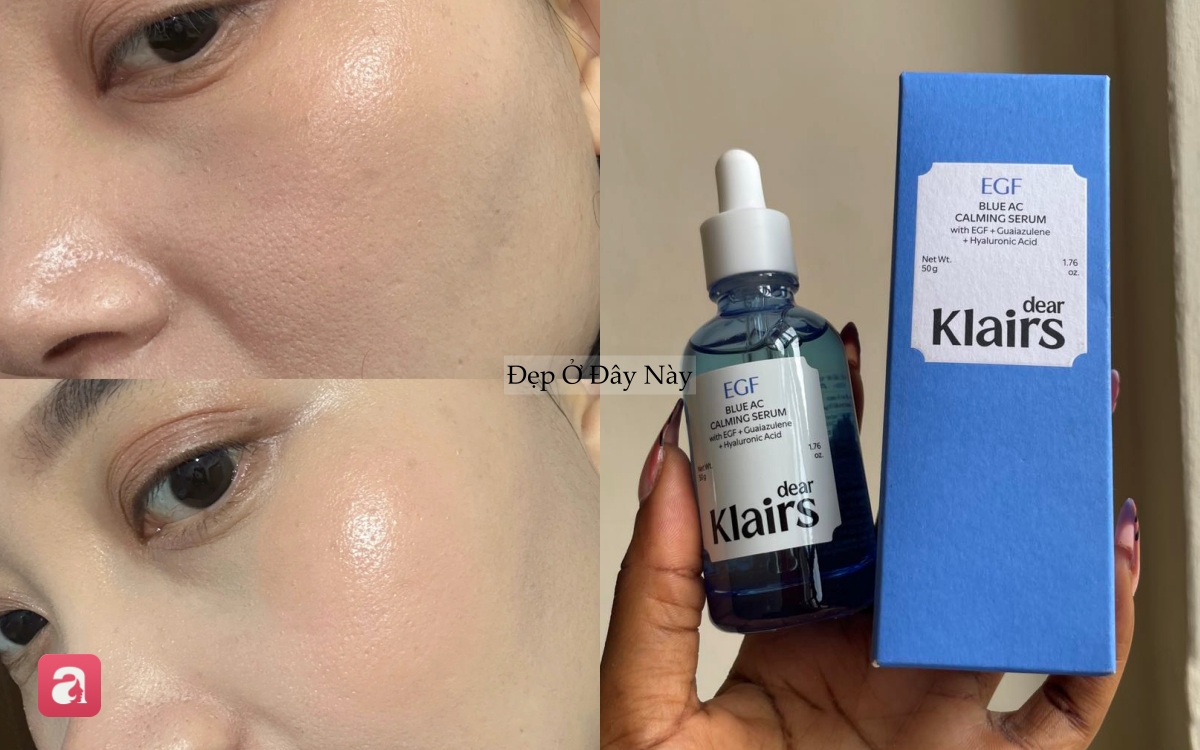 5 "ng&ocirc;i sao chống l&atilde;o h&oacute;a" thay thế retinol, da nhạy cảm cũng d&ugrave;ng được- Ảnh 5.