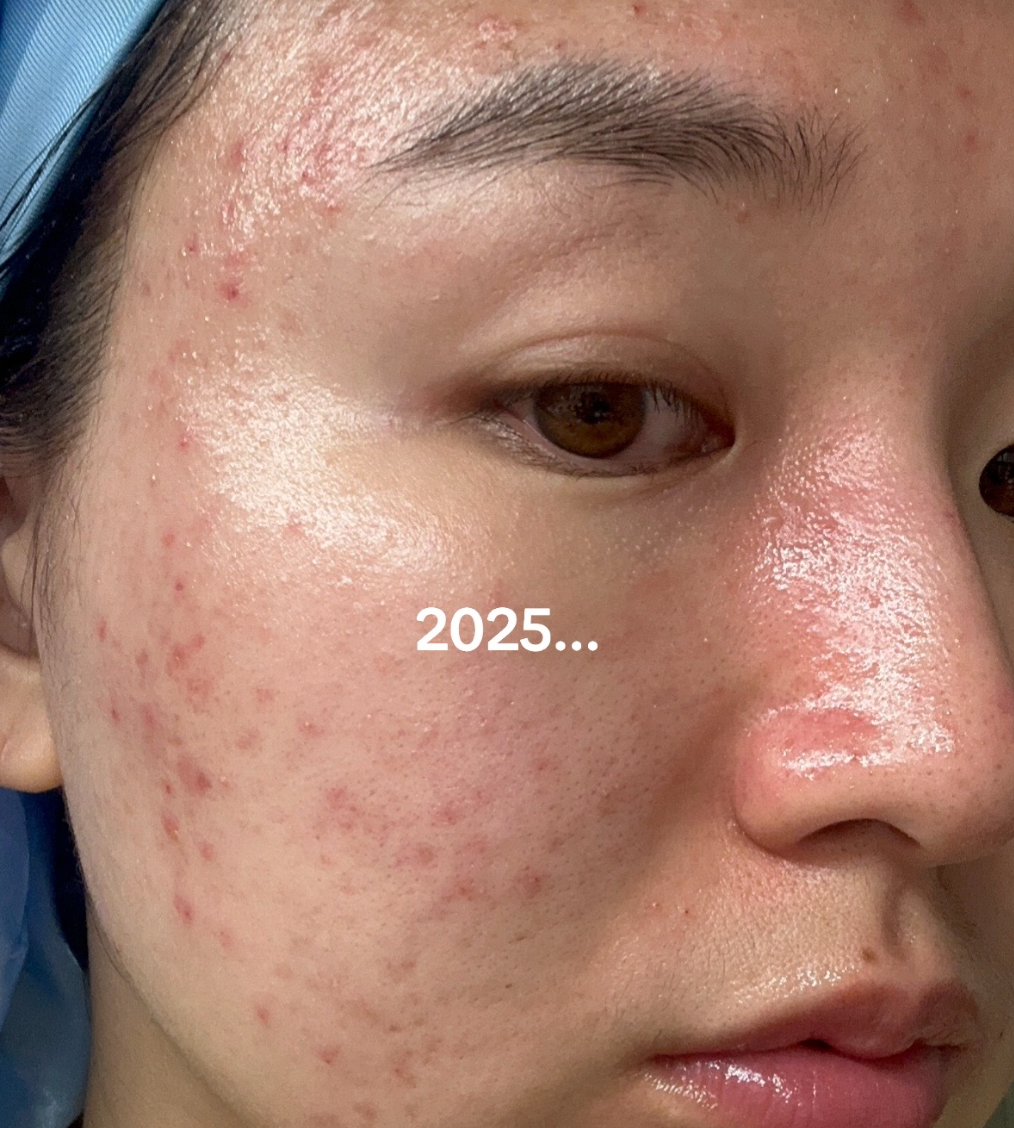 Kh&ocirc;ng chạy theo retinol, phụ nữ H&agrave;n lại tin d&ugrave;ng tu&yacute;p kem dưỡng đạt 4,5* tr&ecirc;n Amazon - Ảnh 10.