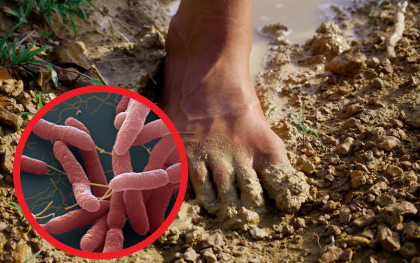 B&eacute; trai 11 tuổi su&yacute;t mất ch&acirc;n v&igrave; 1 loại vi khuẩn được v&iacute; l&agrave; "s&aacute;t thủ v&ocirc; h&igrave;nh" thường cư tr&uacute; tự nhi&ecirc;n tr&ecirc;n da v&agrave; khoang mũi - Ảnh 2.