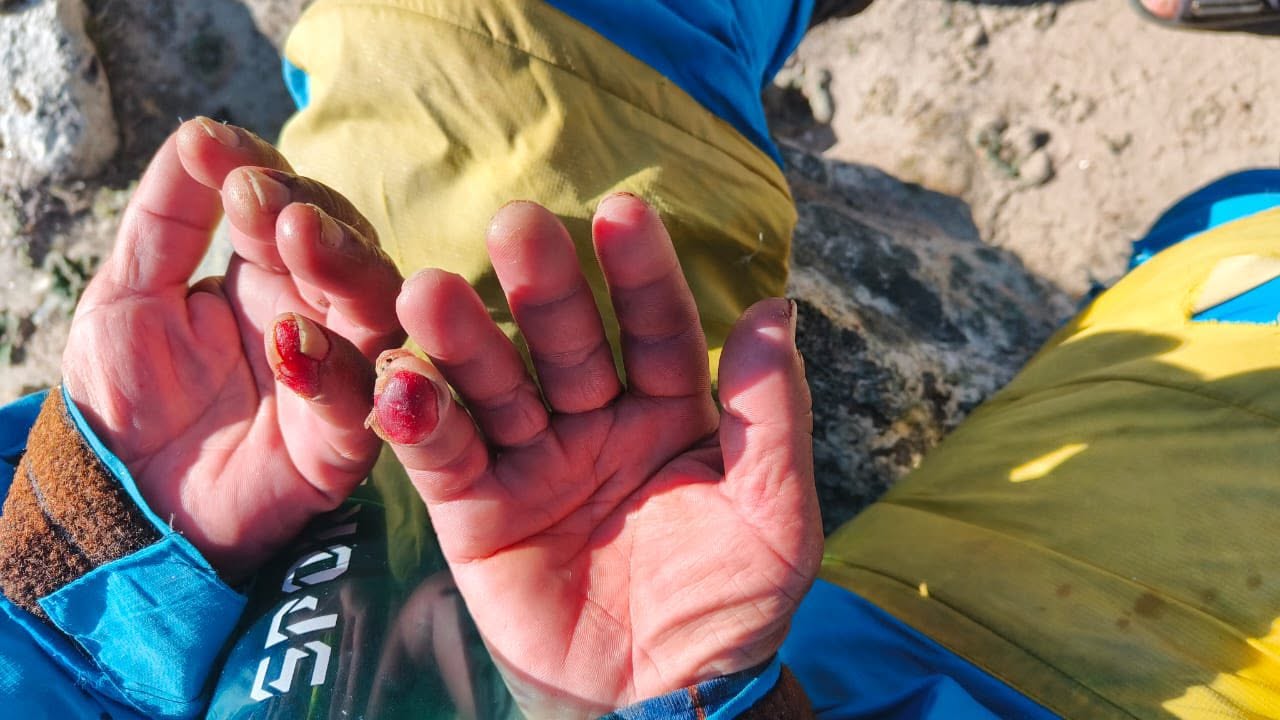 Kỳ t&iacute;ch tr&ecirc;n Everest: Người đ&agrave;n &ocirc;ng sống s&oacute;t sau 7 ng&agrave;y mất t&iacute;ch ở "v&ugrave;ng tử thần"- Ảnh 5.