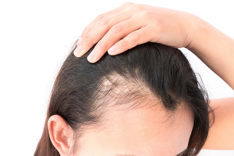 Gội đầu kiểu n&agrave;y cực hại da đầu lại dễ g&acirc;y h&oacute;i: Đ&aacute;ng tiếc nhiều người Việt vẫn mắc, thay đổi ngay h&ocirc;m nay để cứu lấy m&aacute;i t&oacute;c- Ảnh 2.