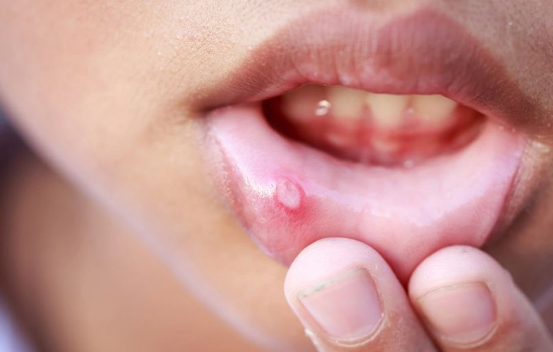 Người đ&agrave;n &ocirc;ng 53 tuổi c&oacute; dấu hiệu ung thư suốt 2 th&aacute;ng m&agrave; kh&ocirc;ng biết - Ảnh 1.