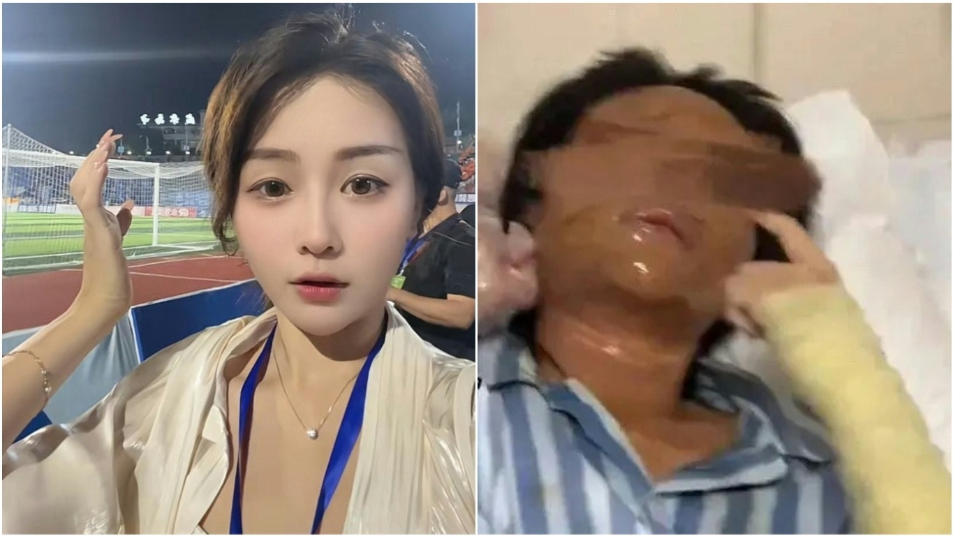 Nữ streamer xinh đẹp bị “hủy dung” sau khi mở gói hàng, danh tính shipper được tiết lộ khiến cô hoảng sợ- Ảnh 1. Nữ streamer xinh đẹp bị “hủy dung” sau khi mở gói hàng, danh tính shipper được tiết lộ khiến cô hoảng sợ- Ảnh 1.