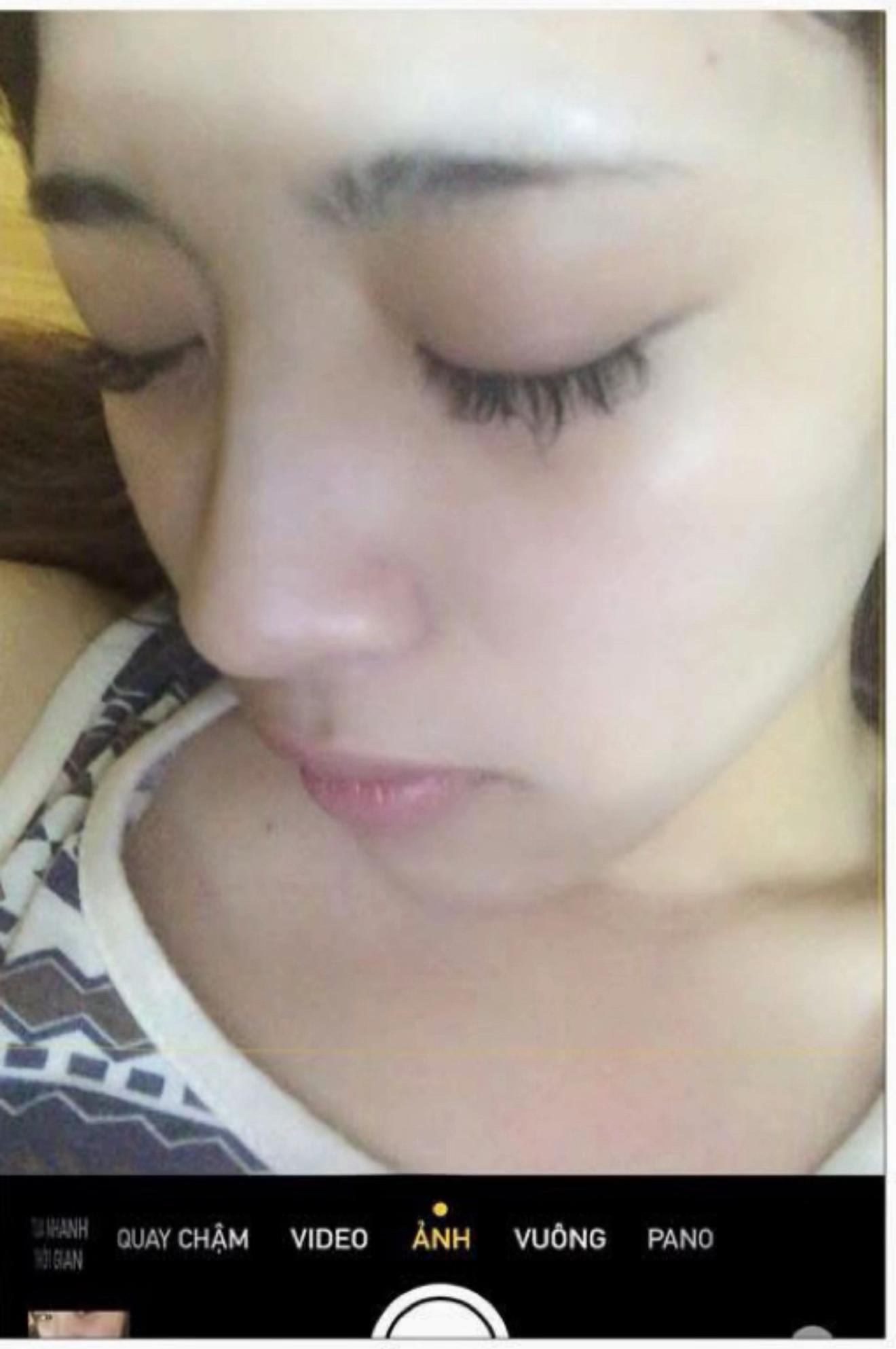 Trần B&iacute;ch Hạnh - vợ Văn Thanh th&aacute;o sụn mũi, đăng lu&ocirc;n nhan sắc &ldquo;nguy&ecirc;n thuỷ&rdquo; đ&aacute;p trả lời ch&ecirc; bai - Ảnh 5.