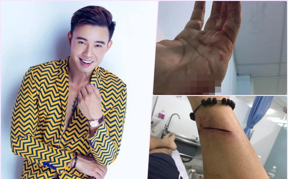 Nam ca sĩ 33 tuổi c&oacute; giao diện &ldquo;c&aacute;n bộ&rdquo; bậc nhất Vbiz: Đi h&aacute;t bị chủ nợ bủa v&acirc;y, từng bị &ldquo;tương t&aacute;c&rdquo; v&igrave; m&oacute;n nợ gần 30 tỷ  - Ảnh 4.