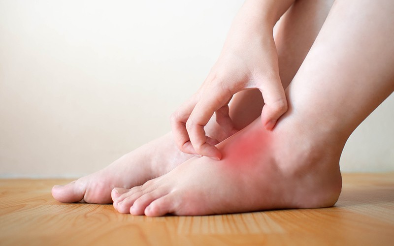 Cảnh b&aacute;o đến những người thường ngứa 3 nơi tr&ecirc;n cơ thể: M&aacute;u đ&atilde; "ngập đường" - Ảnh 2.