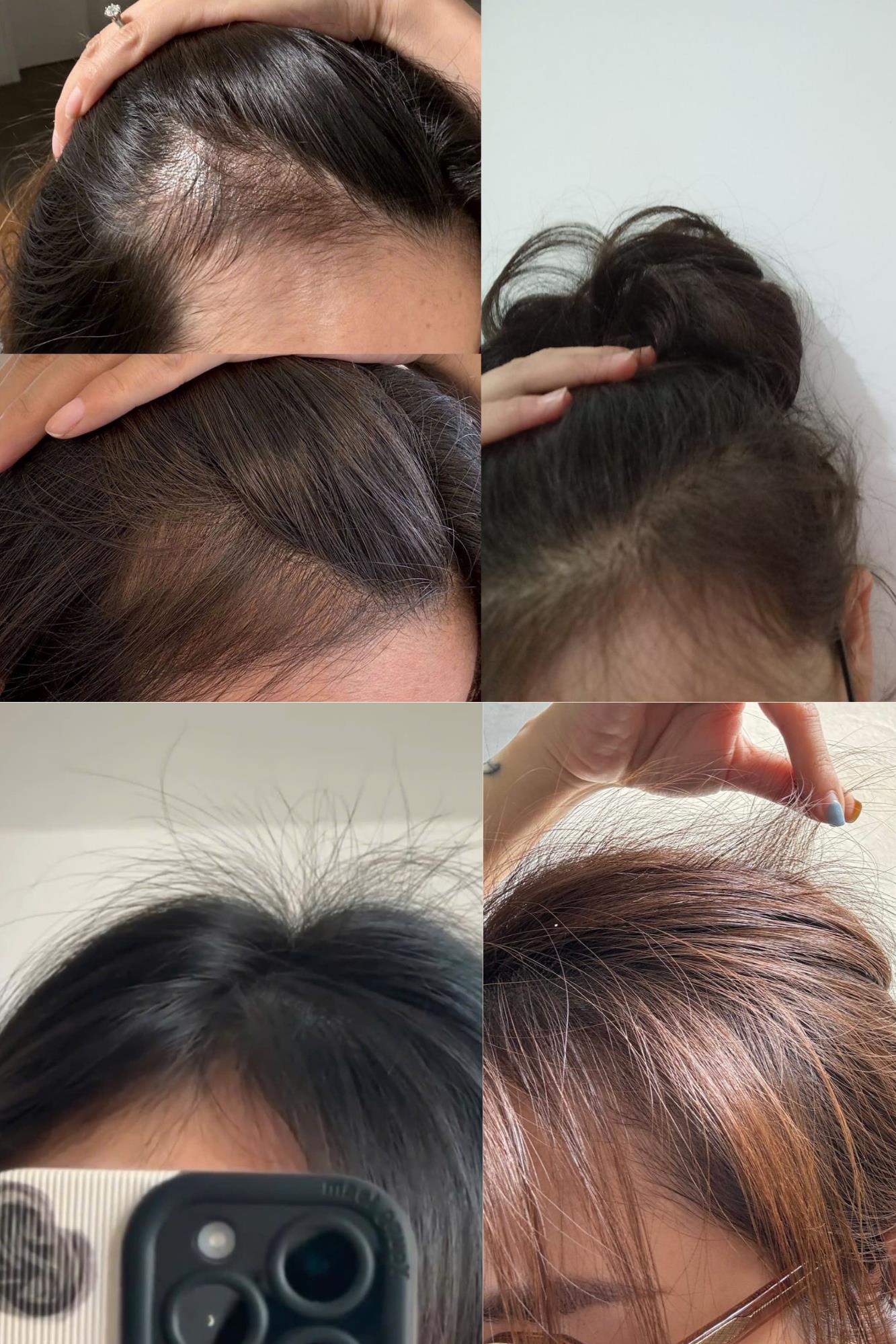 Từ &ldquo;mượt ảo&rdquo; đến &ldquo;khoẻ thật&rdquo;: Theo ch&acirc;n Happi Phạm &ldquo;bắt bệnh&rdquo; da dầu, dưỡng t&oacute;c giảm rụng với Herbario - Ảnh 2.
