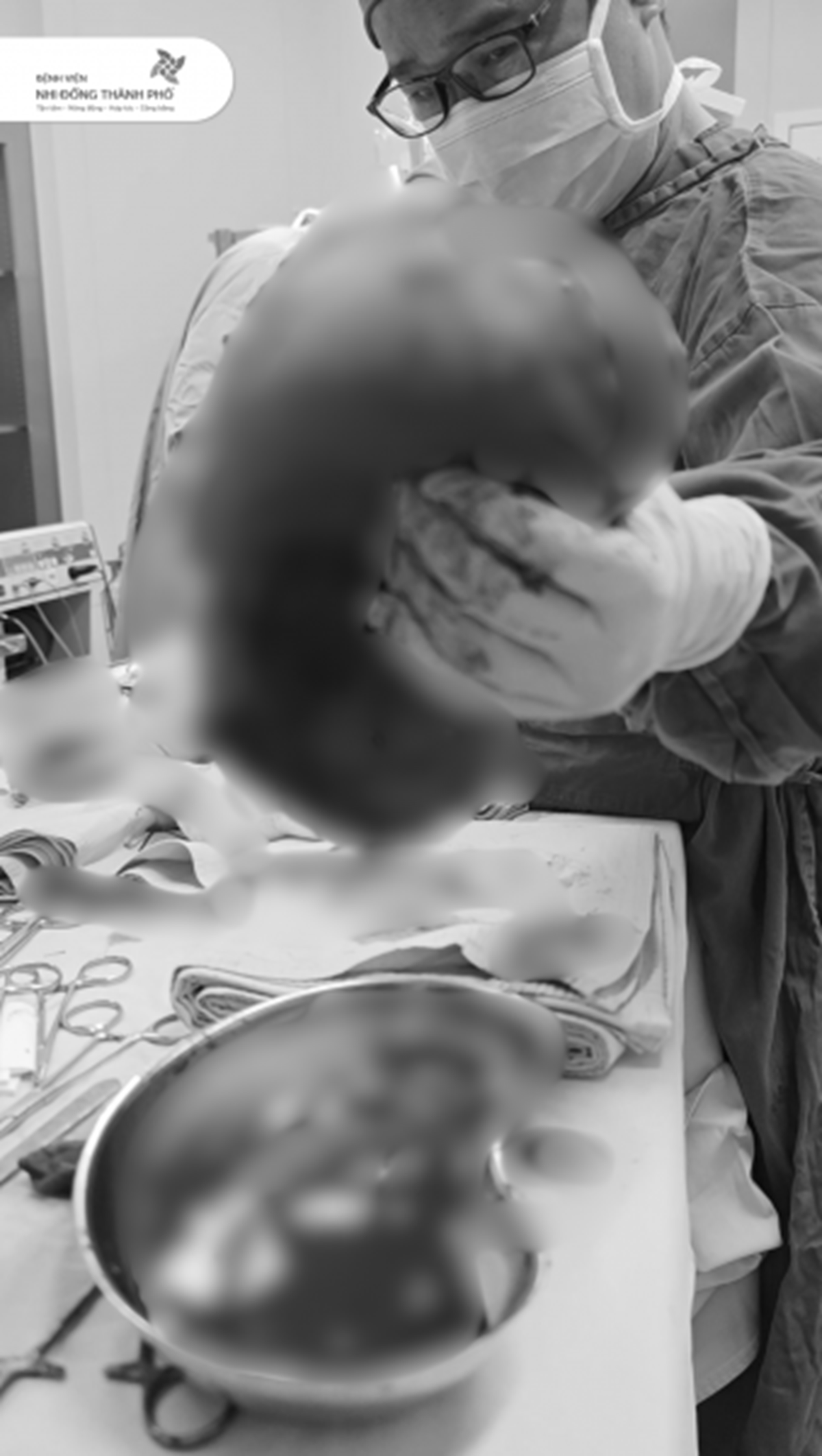 B&eacute; 14 tuổi c&oacute; v&ugrave;ng m&ocirc;ng to bất thường, sự thật ph&iacute;a sau khiến gia đ&igrave;nh "sốc ngang" - Ảnh 1.