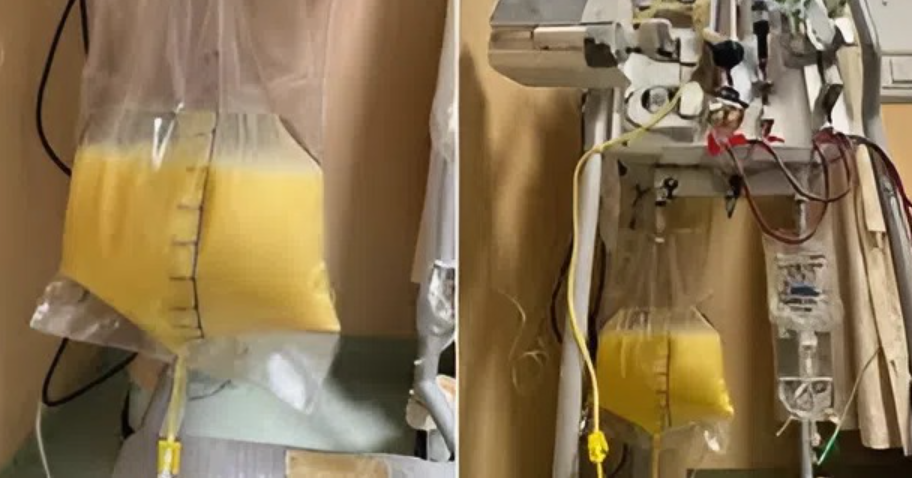 Người phụ nữ 32 tuổi "m&aacute;u trắng đục như sữa" v&igrave; thứ quen thuộc trong tủ thuốc - Ảnh 1.