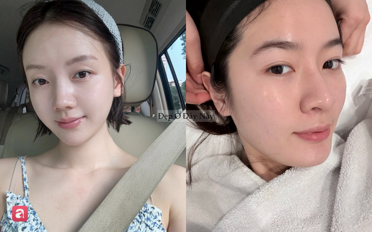 5 c&aacute;ch bảo tồn collagen, ngừa l&atilde;o h&oacute;a cho da m&agrave; "kh&ocirc;ng tốn một đồng"- Ảnh 4.