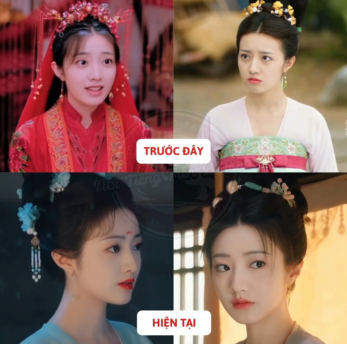 Viral mỹ nh&acirc;n chỉ niềng răng m&agrave; visual thăng hạng kh&oacute; tin: 2026 hot ngo&agrave;i sức tưởng tượng, l&ecirc;n mạng nh&igrave;n đ&acirc;u cũng thấy- Ảnh 1.