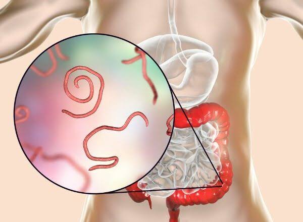 Tr&agrave;o lưu "detox tẩy giun s&aacute;n" tr&ecirc;n mạng x&atilde; hội: B&aacute;c sĩ cảnh b&aacute;o nguy hiểm, kh&ocirc;ng c&oacute; bằng chứng khoa học - Ảnh 2.