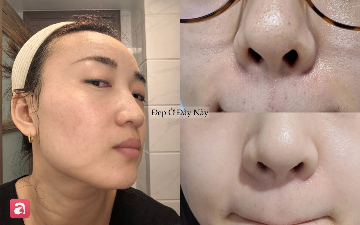 V&igrave; sao c&agrave;ng dưỡng nhiều da c&agrave;ng xấu? 5 sai lầm khiến skincare m&atilde;i kh&ocirc;ng hiệu quả- Ảnh 2.