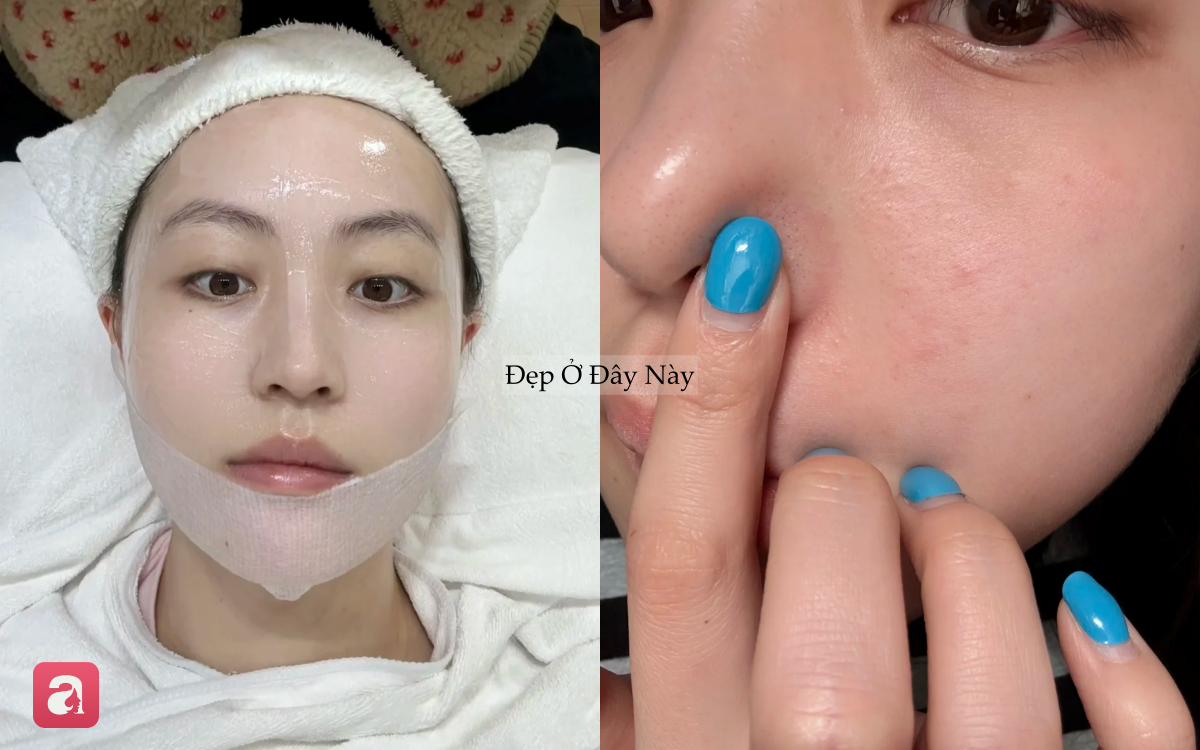 V&igrave; sao c&agrave;ng dưỡng nhiều da c&agrave;ng xấu? 5 sai lầm khiến skincare m&atilde;i kh&ocirc;ng hiệu quả- Ảnh 3.