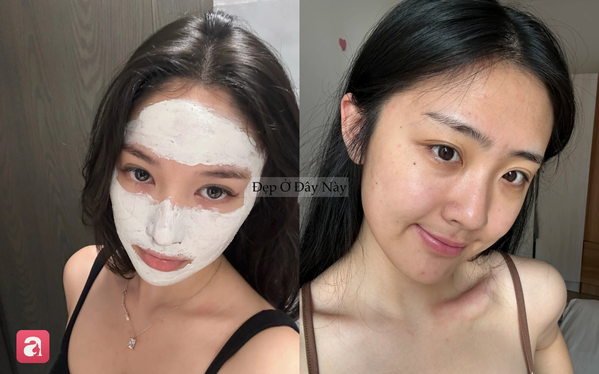 V&igrave; sao c&agrave;ng dưỡng nhiều da c&agrave;ng xấu? 5 sai lầm khiến skincare m&atilde;i kh&ocirc;ng hiệu quả- Ảnh 5.