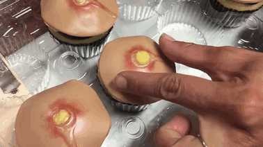 V&igrave; sao nặn mụn hay ngo&aacute;y tai lại mang lại cảm gi&aacute;c sướng kỳ lạ đến thế?  - Ảnh 3.