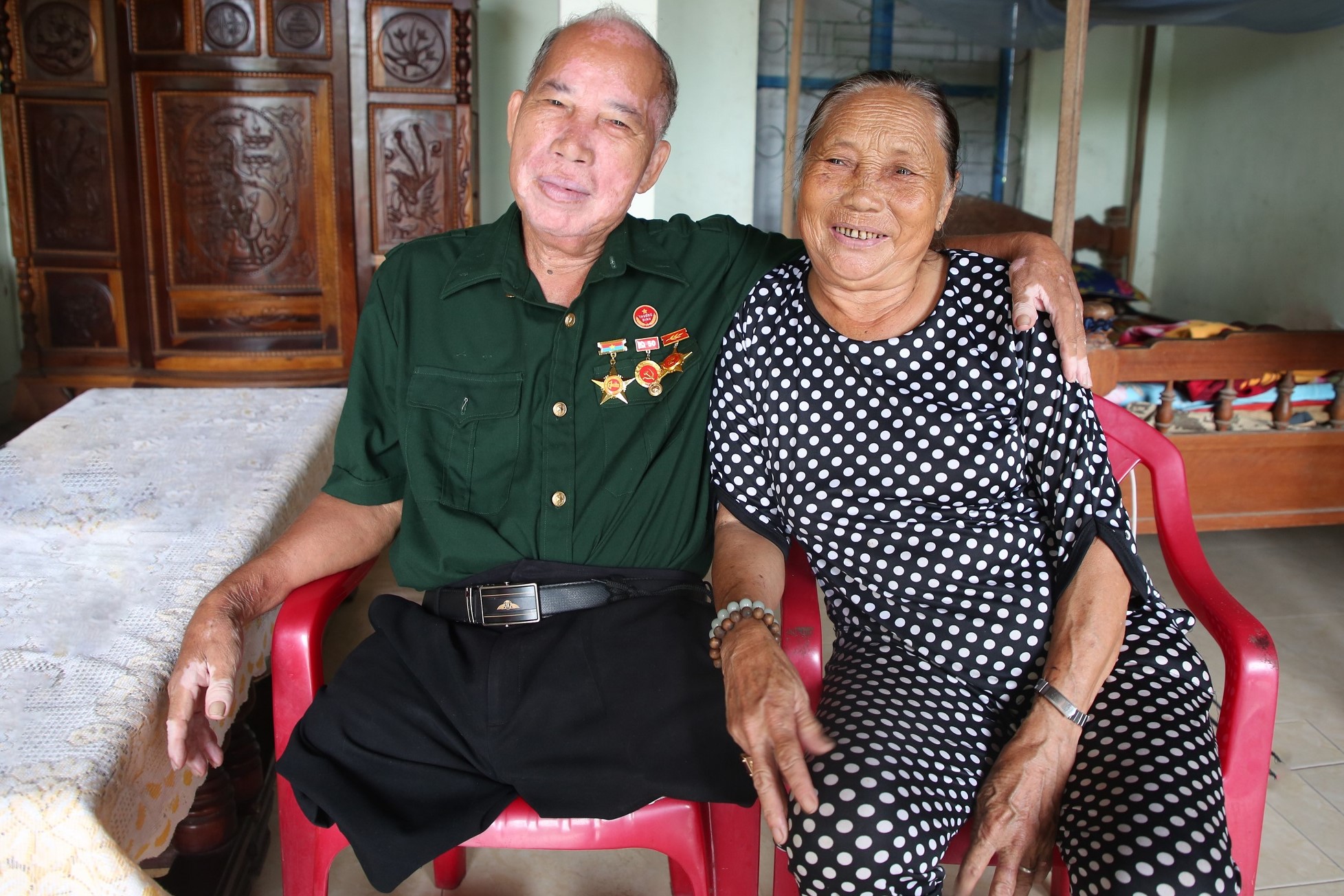 Chuyện người lính mất hai chân ở Đà Nẵng xin người yêu quên mình, nhận lại bức thư chỉ vỏn vẹn một lời hứa- Ảnh 1.