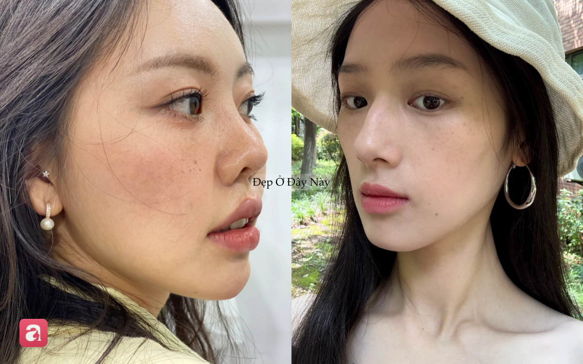 5 sai lầm tưởng nhỏ nhưng lại khiến da dễ bị n&aacute;m: Nhiều chị em vẫn mắc phải mỗi ng&agrave;y - Ảnh 1.