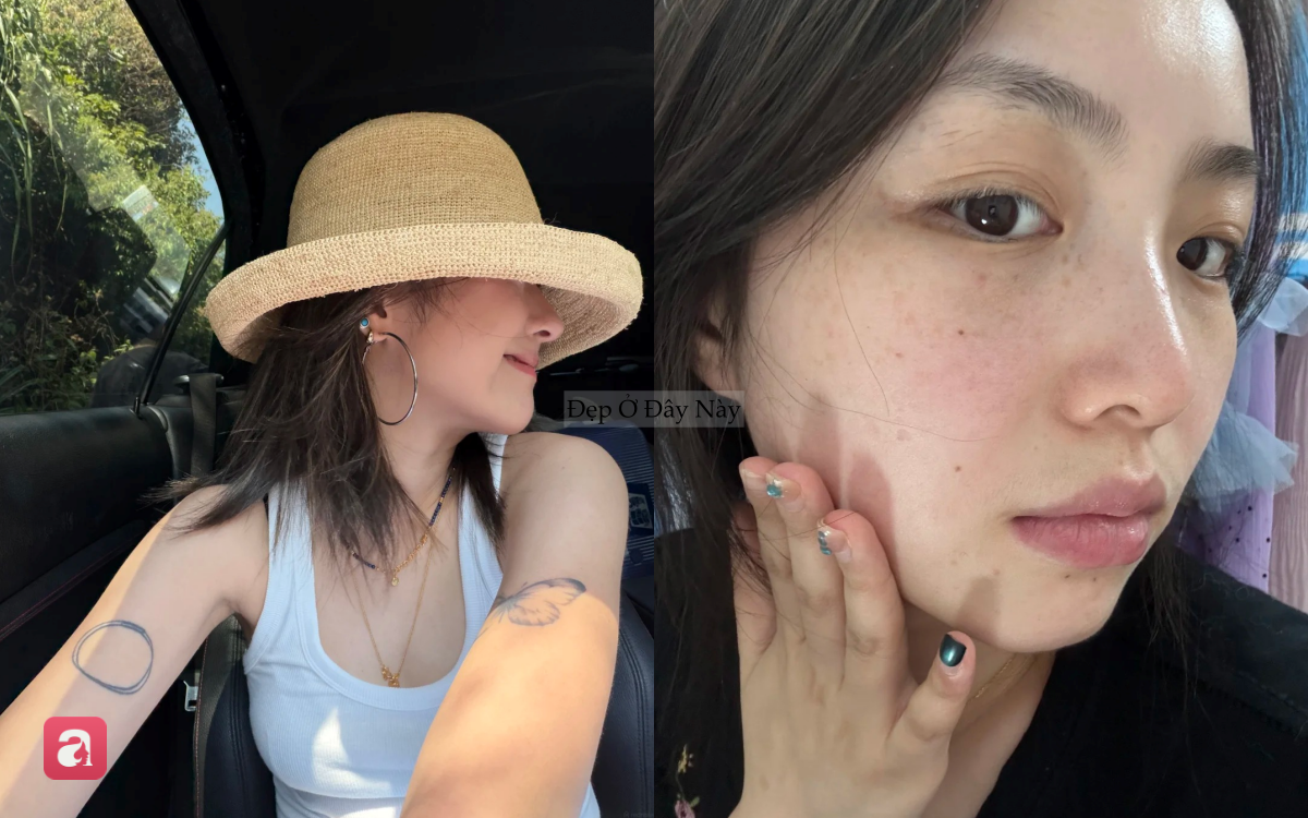 5 sai lầm tưởng nhỏ nhưng lại khiến da dễ bị n&aacute;m: Nhiều chị em vẫn mắc phải mỗi ng&agrave;y - Ảnh 3.