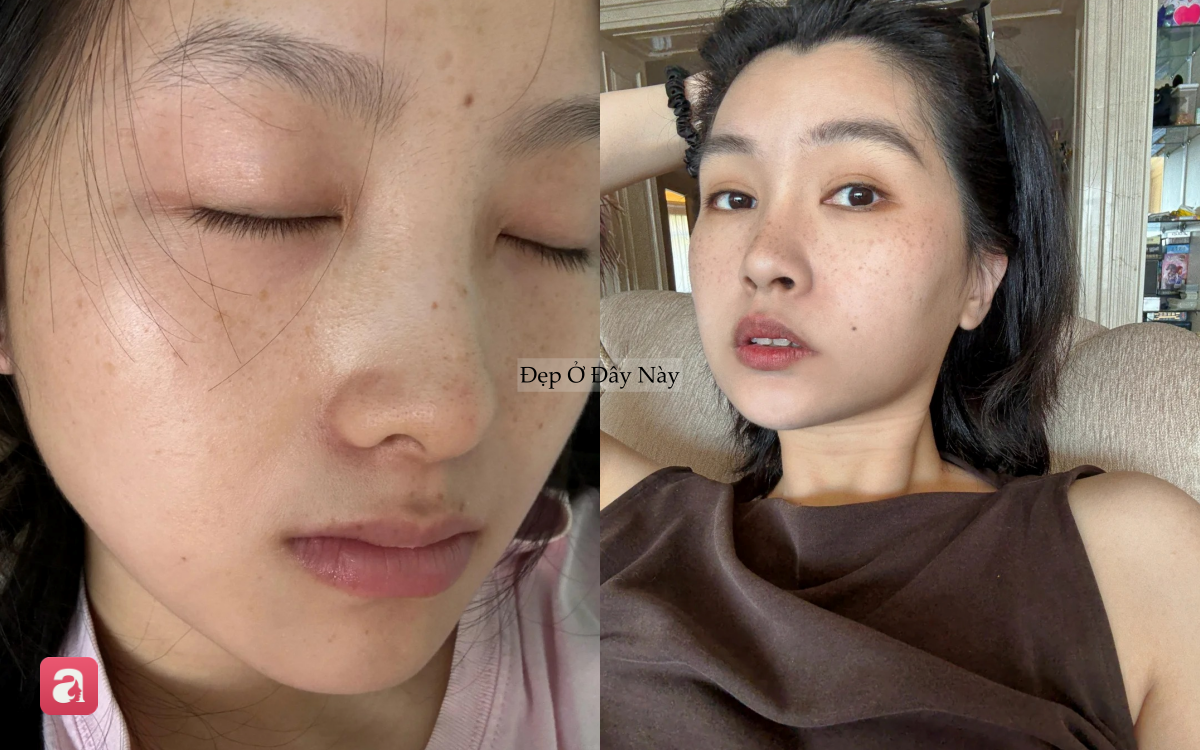 5 sai lầm tưởng nhỏ nhưng lại khiến da dễ bị n&aacute;m: Nhiều chị em vẫn mắc phải mỗi ng&agrave;y - Ảnh 4.