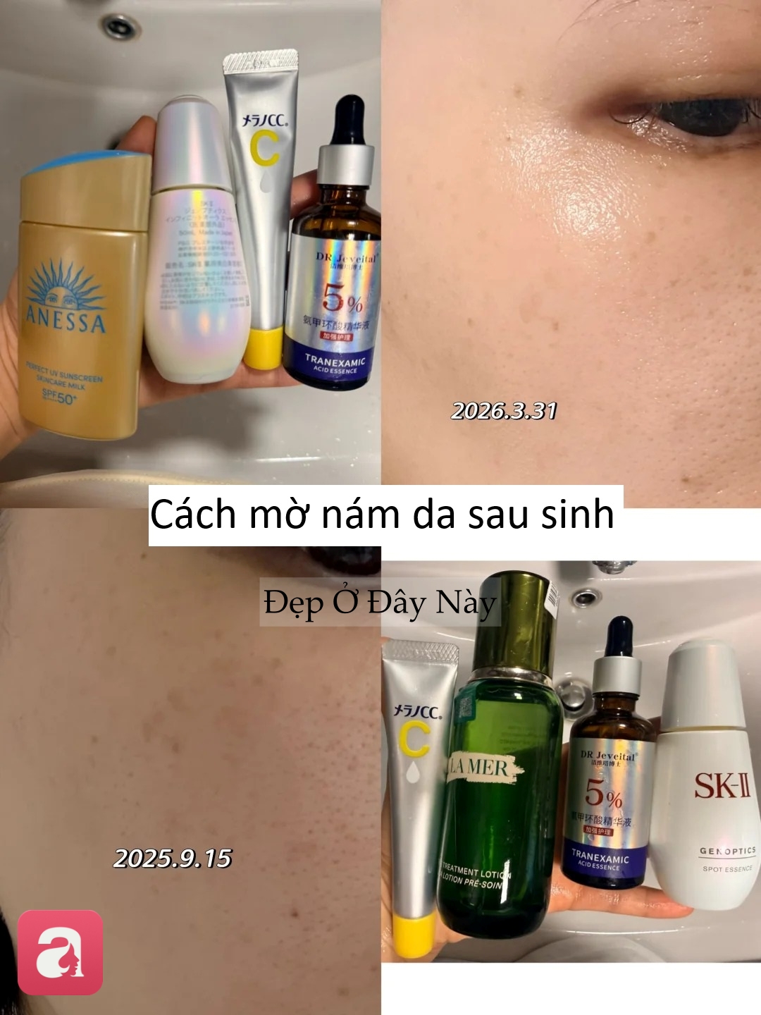 Từng khổ sở v&igrave; n&aacute;m sau sinh, t&ocirc;i t&igrave;m lại l&agrave;n da s&aacute;ng khỏe nhờ 3 bước chăm s&oacute;c đơn giản- Ảnh 3.