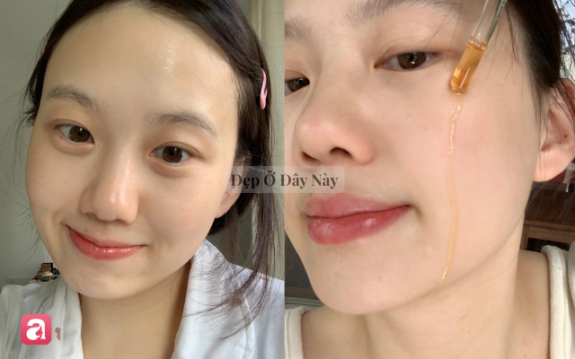 Ki&ecirc;n tr&igrave; &ldquo;s&aacute;ng vitamin C, tối retinol&rdquo; suốt nửa năm, l&agrave;n da mộc của t&ocirc;i thay đổi r&otilde; rệt- Ảnh 1.