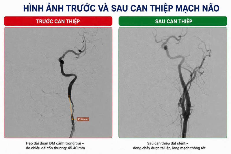 Nam thanh ni&ecirc;n 33 tuổi bất ngờ co giật sau khi tắm - Ảnh 2.
