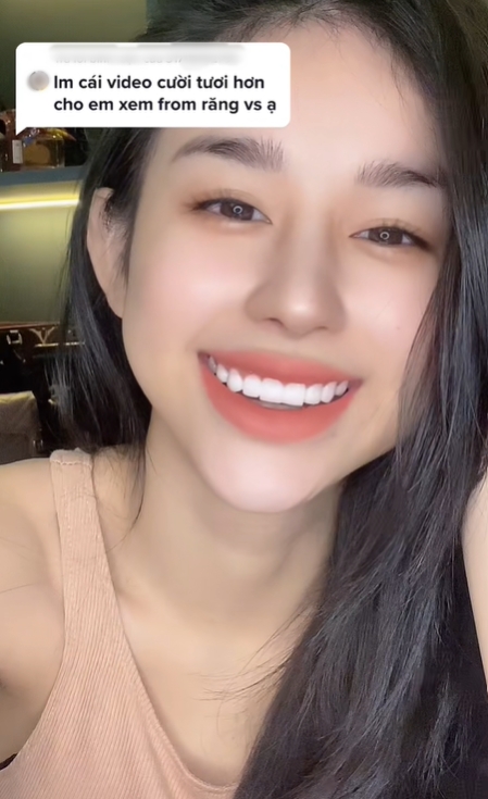 Loạt ảnh Thư Đan Nguyễn l&uacute;c chưa thẩm mỹ hot trở lại- Ảnh 7.