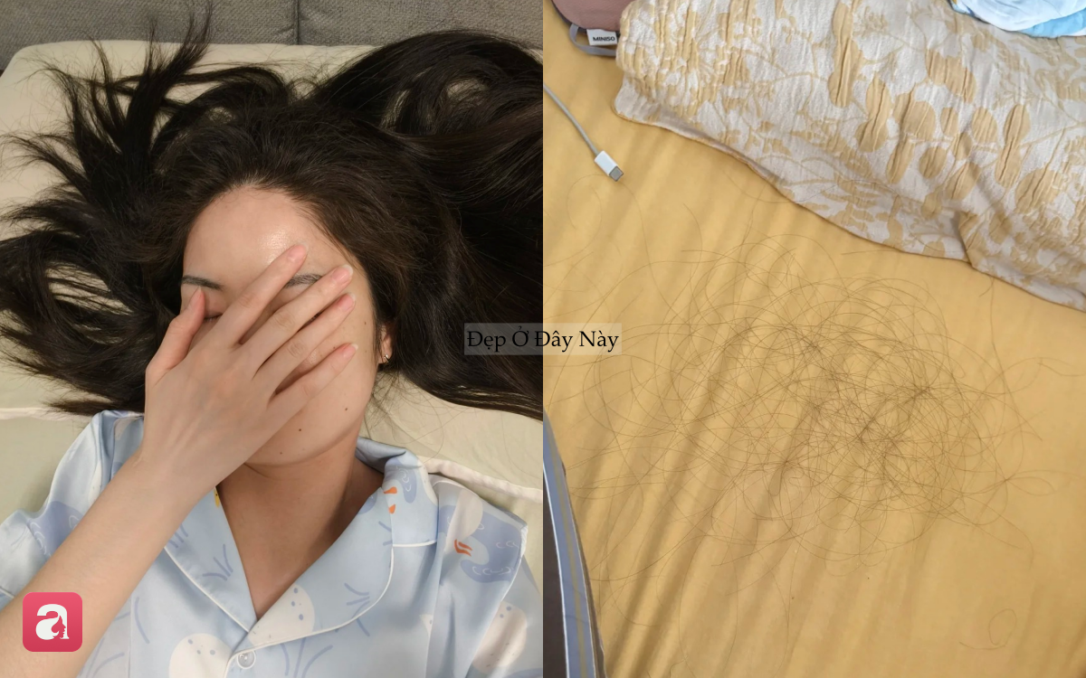 S&aacute;ng n&agrave;o cũng thấy t&oacute;c rụng đầy gối? C&oacute; thể bạn đang mắc 5 sai lầm n&agrave;y trước khi ngủ- Ảnh 1.