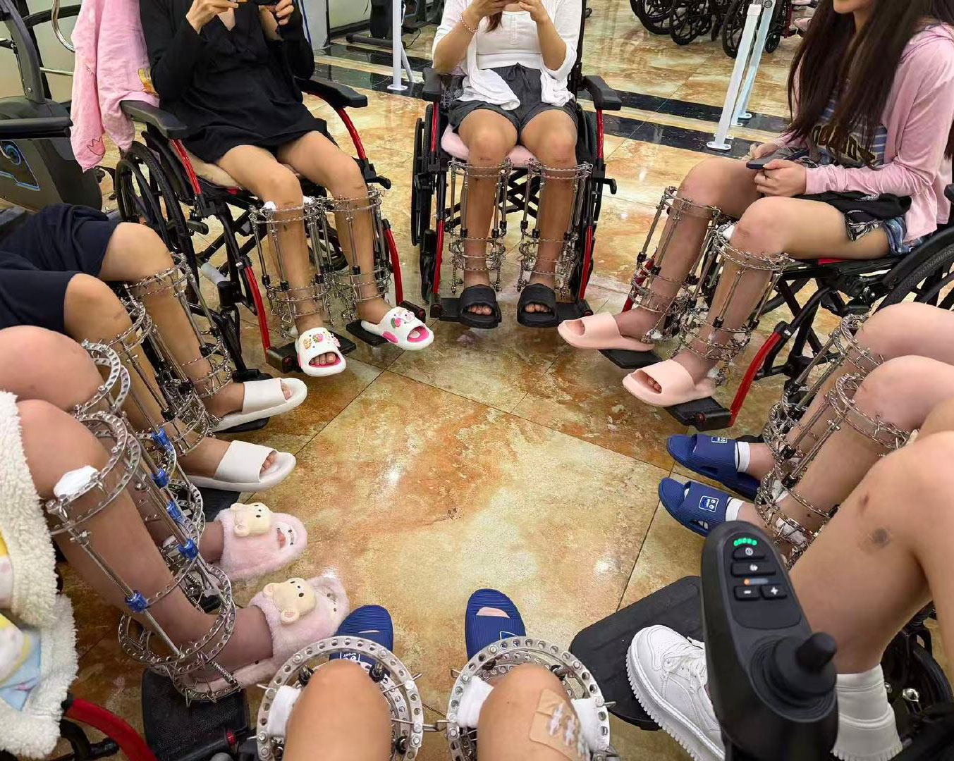Điều tra: B&ecirc;n trong "chợ đen" phẫu thuật tăng chiều cao, hơn 1,5 tỷ đồng đổi lấy từng milim&eacute;t v&agrave; những ca mổ kh&ocirc;ng lộ mặt b&aacute;c sĩ- Ảnh 3.