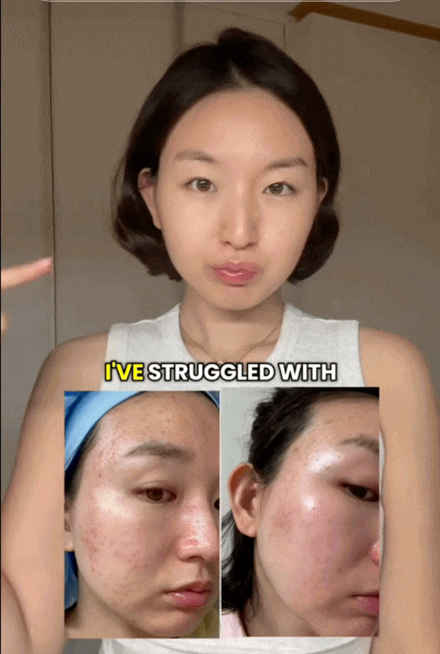 C&ocirc; n&agrave;ng H&agrave;n Quốc chấm 10/10 cho tu&yacute;p kem dưỡng n&agrave;y, nhưng c&aacute;ch c&ocirc; b&ocirc;i kem mới l&agrave; "chi&ecirc;u" gi&uacute;p da căng mịn, đẹp l&ecirc;n từng ng&agrave;y- Ảnh 5.