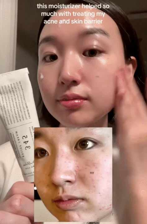 C&ocirc; n&agrave;ng H&agrave;n Quốc chấm 10/10 cho tu&yacute;p kem dưỡng n&agrave;y, nhưng c&aacute;ch c&ocirc; b&ocirc;i kem mới l&agrave; "chi&ecirc;u" gi&uacute;p da căng mịn, đẹp l&ecirc;n từng ng&agrave;y- Ảnh 8.