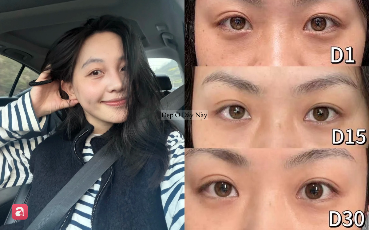 B&aacute;c sĩ da liễu chấm 10/10 cho 6 loại kem mắt n&agrave;y: Gi&aacute; b&igrave;nh d&acirc;n, hiệu quả tốt, ngừa nhăn từ b&ecirc;n trong- Ảnh 1.