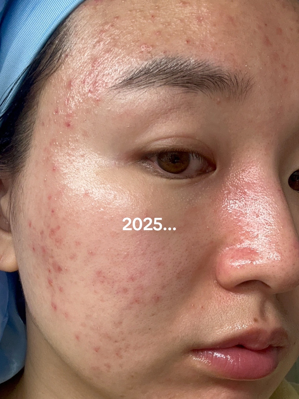 C&ocirc; n&agrave;ng H&agrave;n Quốc chấm 10/10 cho tu&yacute;p kem dưỡng n&agrave;y, nhưng c&aacute;ch c&ocirc; b&ocirc;i kem mới l&agrave; "chi&ecirc;u" gi&uacute;p da căng mịn, đẹp l&ecirc;n từng ng&agrave;y- Ảnh 1.