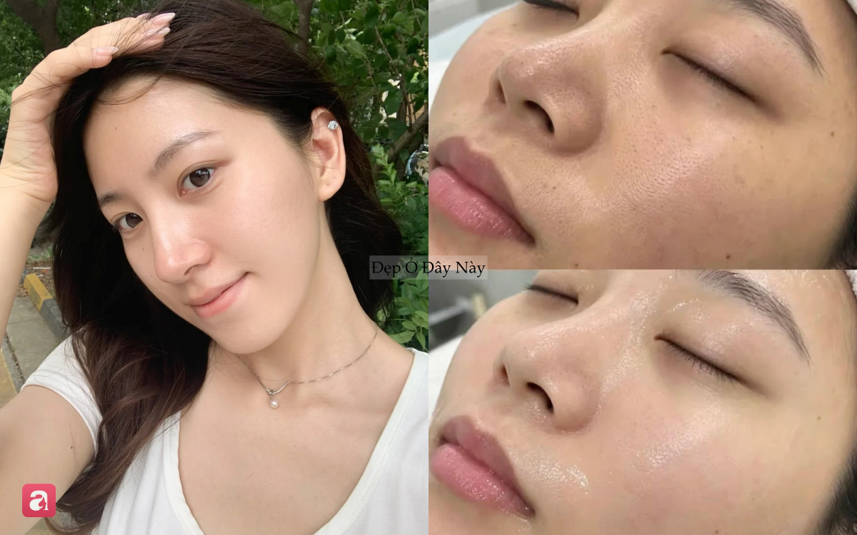 B&aacute;c sĩ da liễu chọn ra 7 loại "retinol thế hệ mới" đ&aacute;ng sắm nhất: L&agrave;m đầy collagen, phục hồi da m&agrave; &iacute;t g&acirc;y bong tr&oacute;c - Ảnh 1.