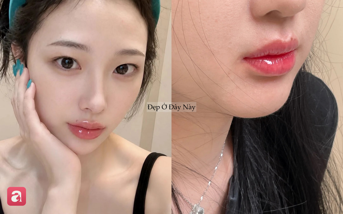 M&ocirc;i ng&agrave;y c&agrave;ng th&acirc;m m&agrave; kh&ocirc;ng biết v&igrave; sao? C&oacute; thể bạn đang mắc 5 sai lầm n&agrave;y mỗi ng&agrave;y - Ảnh 1.