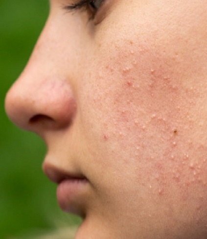 Ở Việt Nam c&oacute; một loại c&acirc;y, vừa gi&uacute;p t&oacute;c &oacute;ng mượt, vừa  k&iacute;ch th&iacute;ch tăng collagen cho da, đến phụ nữ H&agrave;n cũng tận dụng l&agrave;m đẹp mỗi tuần- Ảnh 2.