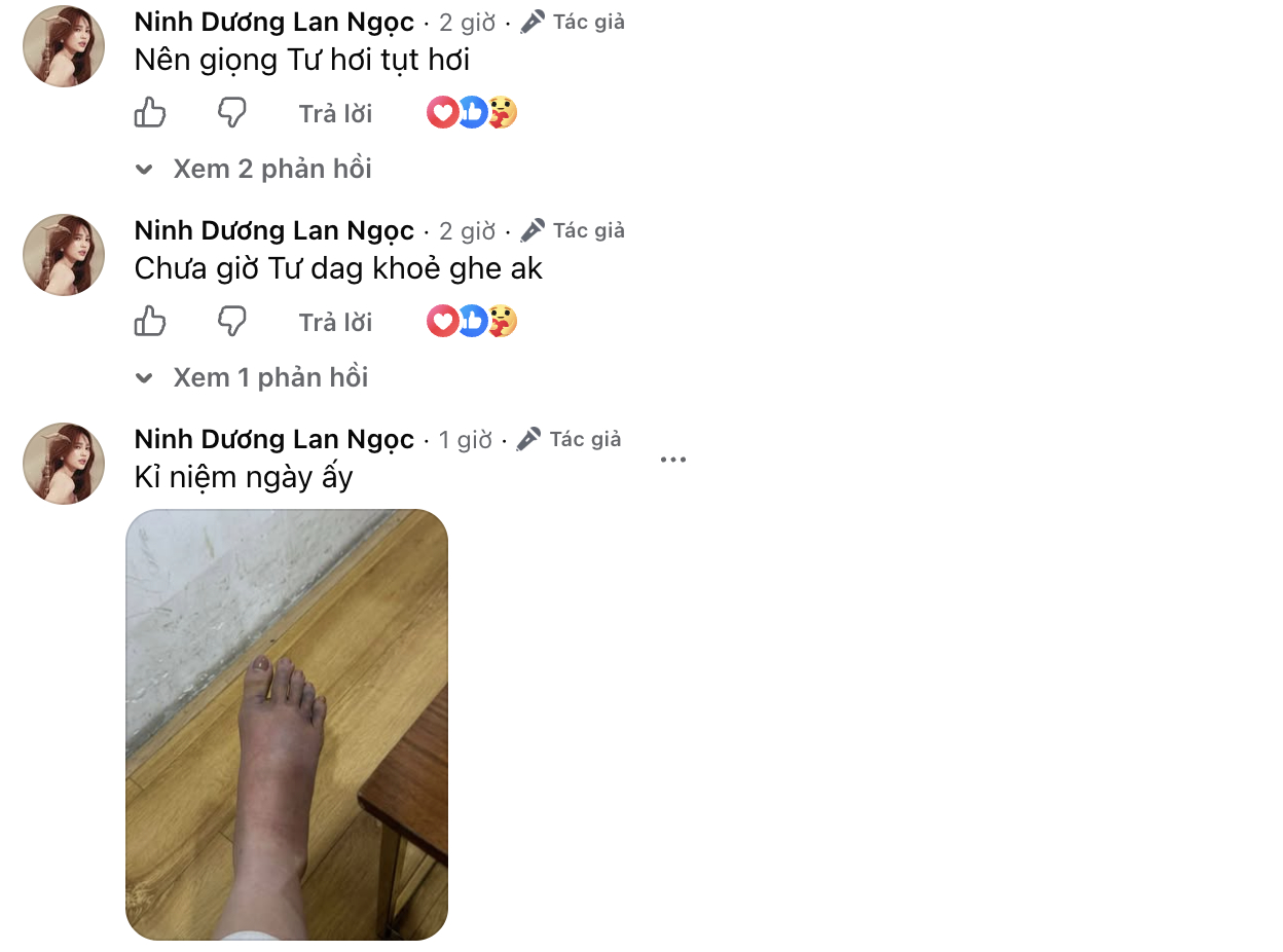 Ninh Dương Lan Ngọc mắc c&uacute;m B, ch&acirc;n sưng to g&acirc;y lo lắng- Ảnh 2.