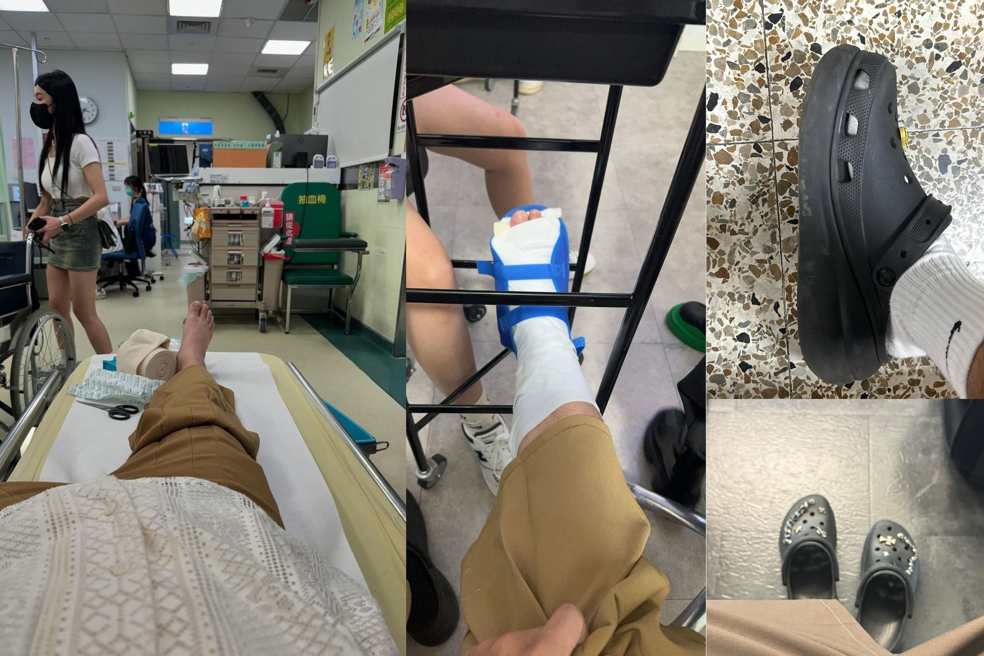 Lời khuy&ecirc;n cho những người th&iacute;ch đi d&eacute;p sục, d&eacute;p "kiểu crocs"- Ảnh 1.