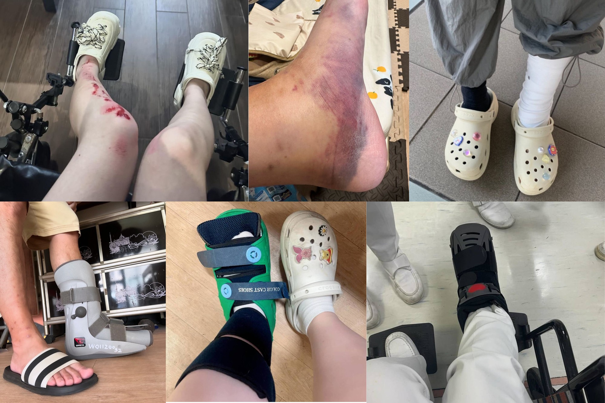 Lời khuy&ecirc;n cho những người th&iacute;ch đi d&eacute;p sục, d&eacute;p "kiểu crocs"- Ảnh 3.