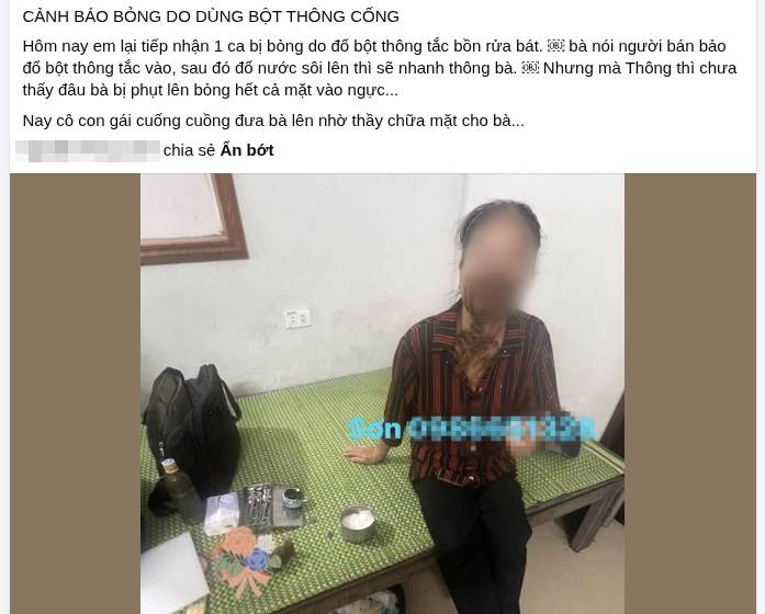 R&ugrave;ng m&igrave;nh th&oacute;i quen dọn nh&agrave; "tưởng v&ocirc; hại": Đổ thứ bột quen thuộc n&agrave;y xuống cống, nhiều người bất ngờ bị bỏng, sẹo chằng chịt- Ảnh 1.