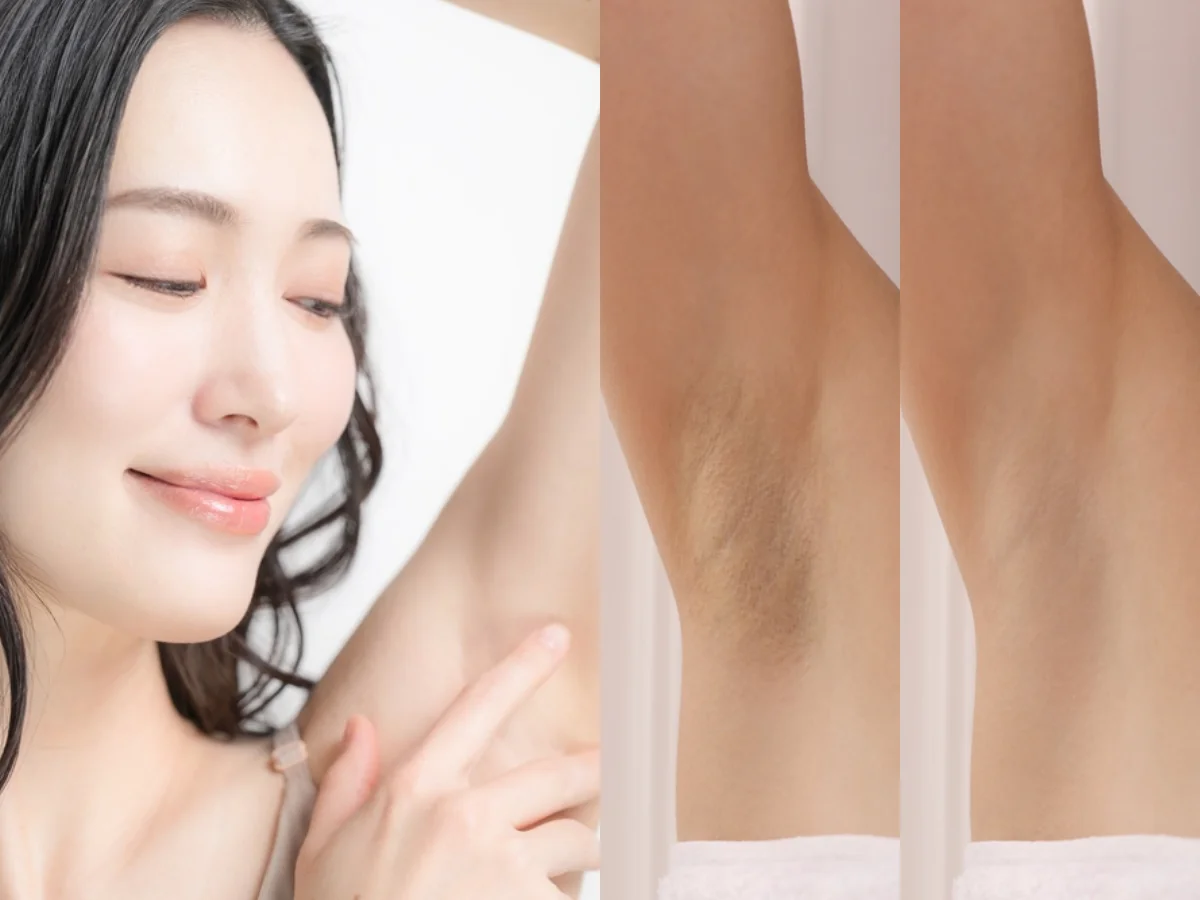 Tự ti không dám mặc áo hai dây, rõ ràng ngày nào cũng tắm sạch, sao