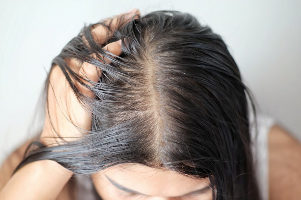 Mới ngoài 30 tuổi, tóc đã bạc nửa đầu, cô gái Hàn Quốc dùng dầu tẩy trang làm sạch tóc, và cái kết bất ngờ- Ảnh 7.