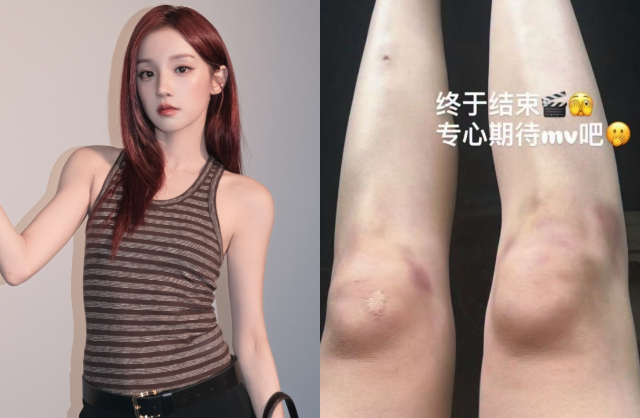 Đ&ocirc;i ch&acirc;n kh&ocirc;ng ai d&aacute;m nh&igrave;n v&agrave;o của ngọc nữ Running Man đang vướng tin hẹn h&ograve; "trai hư lắm phốt" l&agrave;m cả nước x&ocirc;n xao- Ảnh 1.
