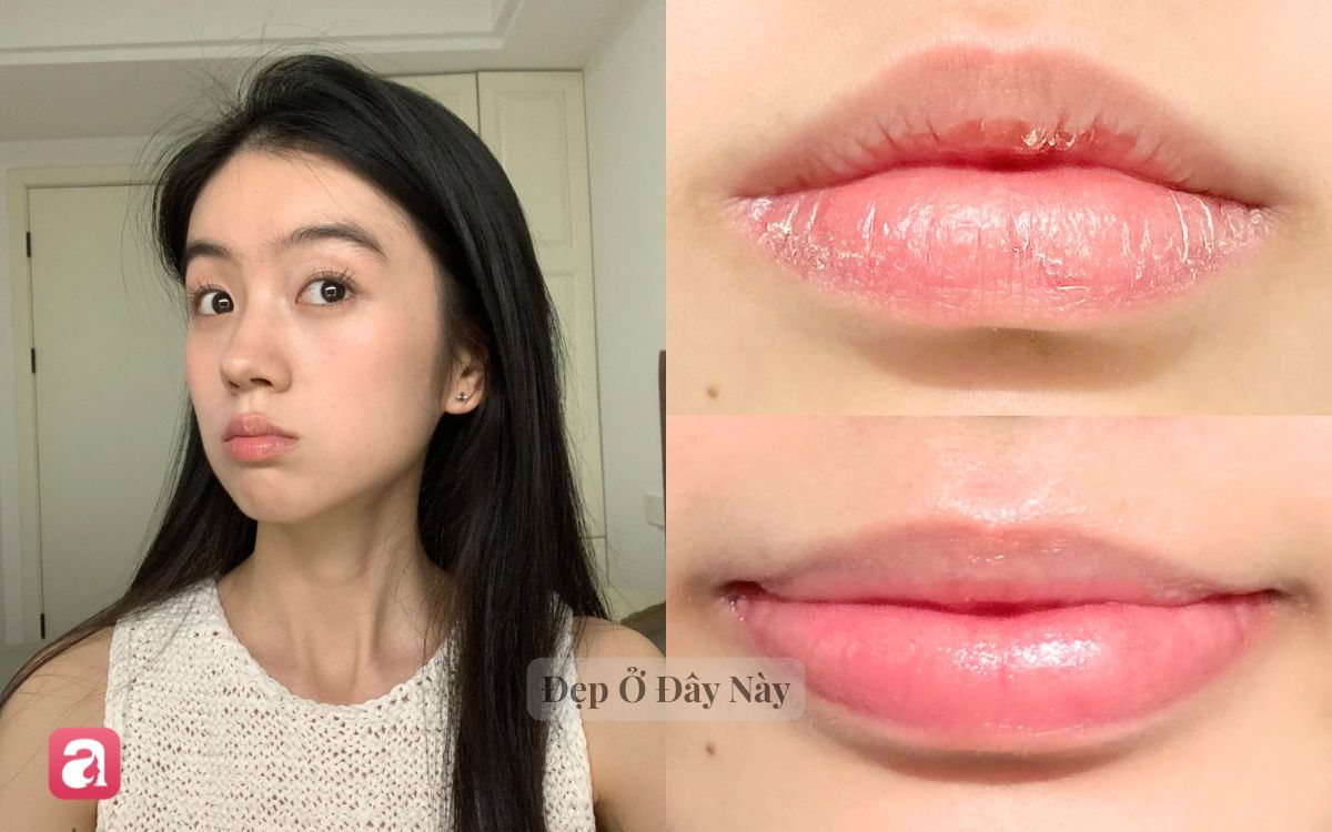 Mỗi tối bôi thứ này, môi sẽ căng mọng hồng hào chẳng cần tô son- Ảnh 1.